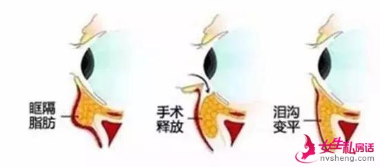 ۴ṵ